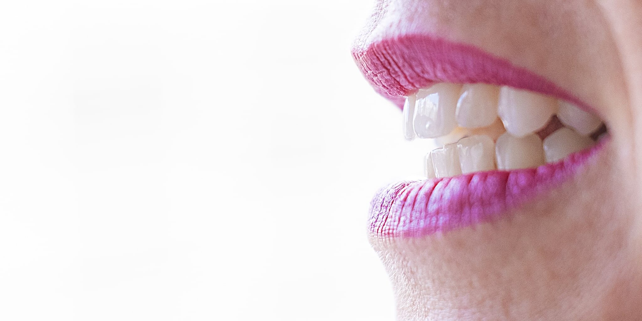 sbiancamento denti