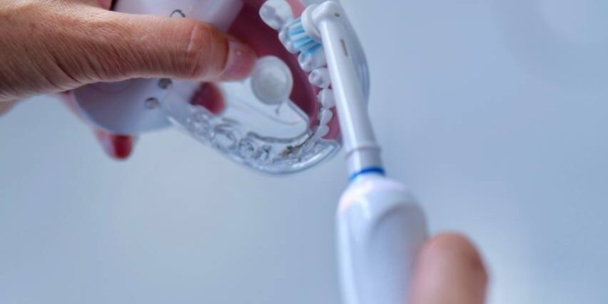 igiene dentale